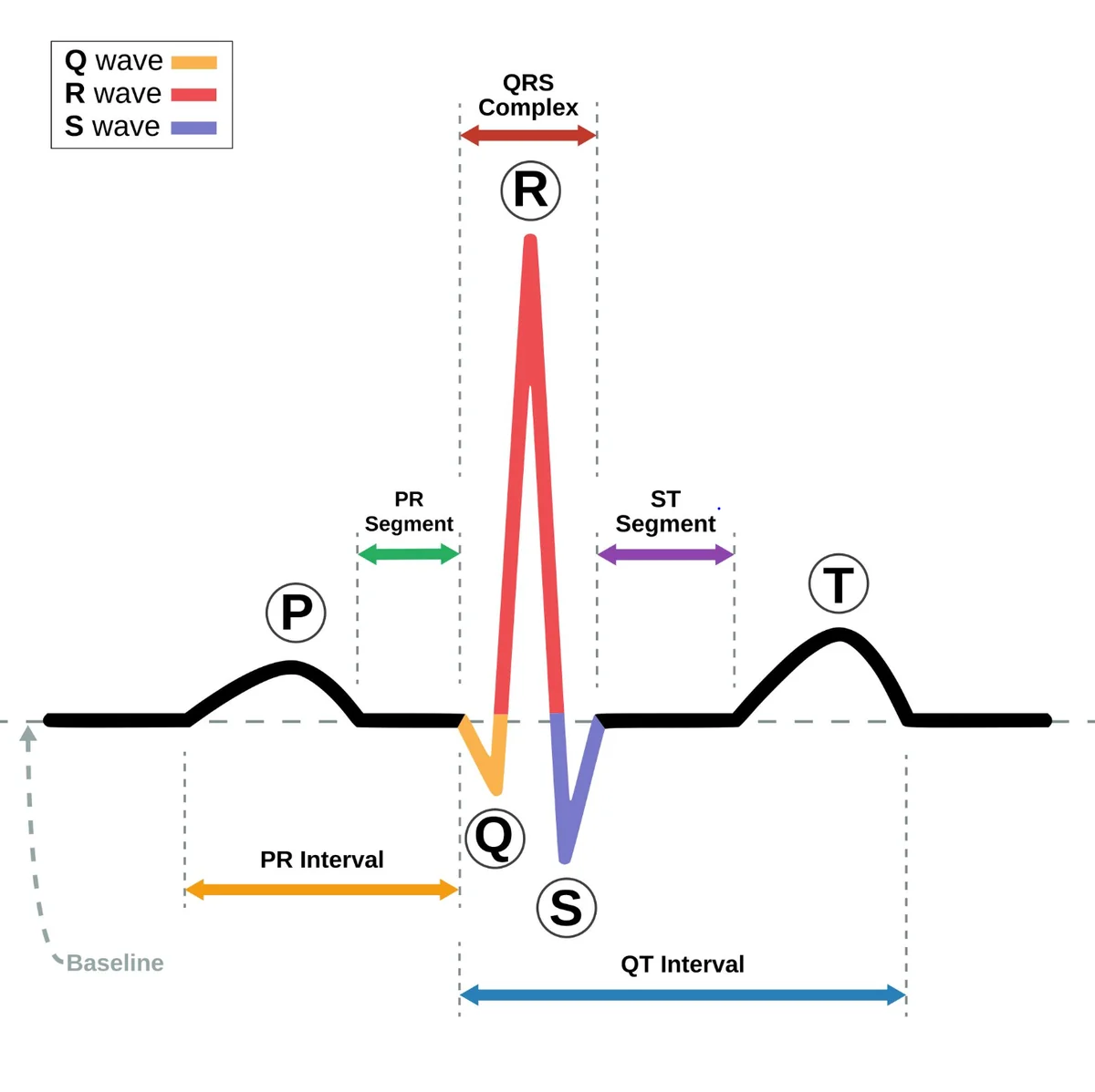 ECG/ EKG Reading  Interpretation for NCLEX and  NMC CBT